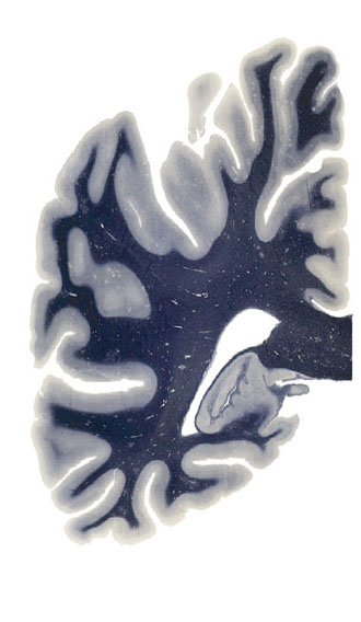 ILLUSTRATION : Gyrus fasciolar (Source : The Human Brain)
