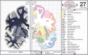 Start Interactive Atlas