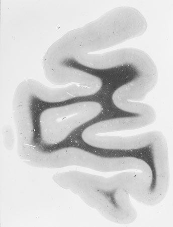 I001w_R1_0898