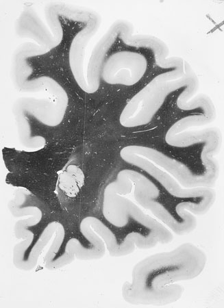 I020w_R2_0651(2)