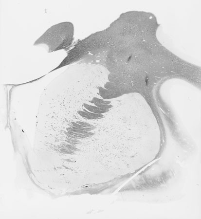 I035w_R2_0045