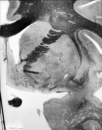 I038w_R3_1476