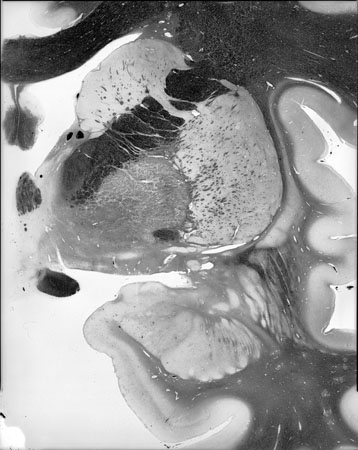 I044w_R3_1302