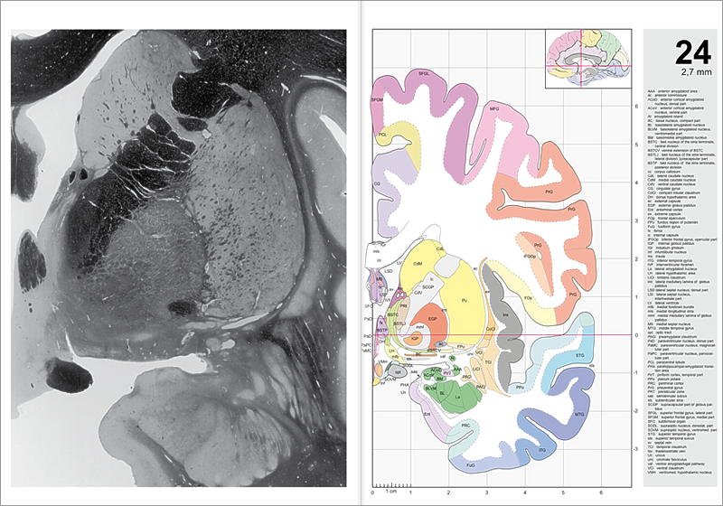  3.2 Plates (Myelin) and Figures, 
	AAA	anterior amygdaloid area ac	anterior commissure ACoD	anterior cortical amygdaloid nucleus, dorsal part ACoV	anterior cortical amygdaloid nucleus, ventral part AI	amygdaloid island BC	basal nucleus, compact part BL	basolateral amygdaloid nucleus BLVM	basolateral amygdaloid nucleus, ventromedial part BM	basomedial amygdaloid nucleus BSTC	bed nucleus of the stria terminalis, central division BSTCV	ventral extension of BSTC BSTLJ	bed nucleus of the stria terminalis, lateral division, juxtacapsular part BSTP	bed nucleus of	the stria terminalis, posterior division cc	corpus callosum CdL	lateral caudate nucleus CdM	medial caudate nucleus CdV	ventral caudate nucleus CG	cingulate gyrus CoCl	compact insular claustrum DH	dorsal hypothalamic area ec	external capsule EGP	external globus pallidus Ent	entorhinal cortex ex	extreme capsule FOp	frontal operculum FPu	fundus region of putamen FuG	fusiform gyrus fx	fornix ic	internal capsule IFGOp	inferior frontal gyrus, opercular part IGP	internal globus pallidus IGr	indusium griseum Inf	infundibular nucleus Ins	insula ITG	inferior temporal gyrus IVF	interventricular foramen La	lateral amygdaloid nucleus LH	lateral hypothalamic area LiCl	limitans claustrum lml	lateral medullary lamina of	globus pallidus LSD lateral septal nucleus, dorsal part LSI	lateral septal nucleus, intermediate part LV	lateral ventricle mfb	medial forebrain bundle mls	medial longitudinal stria mml	medial medullary lamina of globus pallidus MS	medial septal nucleus MTG	middle temporal gyrus opt	optic tract PACl	preamygdalar claustrum PaD	paraventricular nucleus, dorsal part PaMC	paraventricular nucleus, magnocel- lular part PaPC	paraventricular nucleus, parvocel- lular part PCL	paracentral lobule PHA	parahippocampal-amygdaloid transi- tion area PirT	piriform cortex, temporal part PPo	planum polare PRC	perirhinal cortex PrG	precentral gyrus PRT	prereticular zone sas	semiannular sulcus sls	sublenticular stria SCGP	supracapsular part of globus pal- lidus SFGL	superior frontal gyrus, lateral part SFGM	superior frontal gyrus, medial part SFO	subfornical organ SODL	supraoptic nucleus, dorsolat. part SOVM	supraoptic nucleus, ventromed. part STG	superior temporal gyrus sts	superior temporal sulcus sv	septal vein TCl	temporal claustrum tsv	thalamostriate vein Un	uncus unc	uncinate fasciculus vaf	ventral amygdalofugal pathway VCl	ventral claustrum VMH	ventromed. hypothalamic nucleus
	