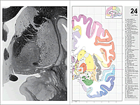 Preview of the Atlas of the Human Brain &ndash; Pages 140 &ndash; 141 &ndash; Chapter: 3.2 Plates (Myelin) and Figures