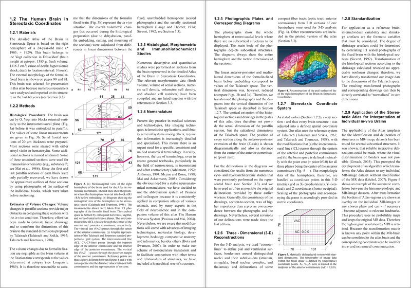 1.2.1 Materials, 1.2.2 Methods, Histological Procedures: Estimates of Volume Changes: 1.2.4 Nomenclature, 1.2.3 Histological, Morphometric and Immunohistochemical Studies, 1.2.5 Photographic Plates and Corresponding Diagrams, 1.2.7 Stereotaxic Coordinate System, 1.2.6   Three - Dimensional (3-D) Reconstructions, 1.2.9 Application of the Stereo- taxic Atlas for Interpretation of Individual in-vivo Brains, 1.2.8 Standardization