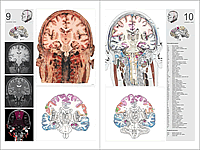 Preview of the Atlas of the Human Brain &ndash; Pages 60 &ndash; 61 &ndash; Chapter: Coronal Atlas