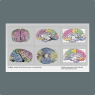 Surface views of the brain prior to sectioning 