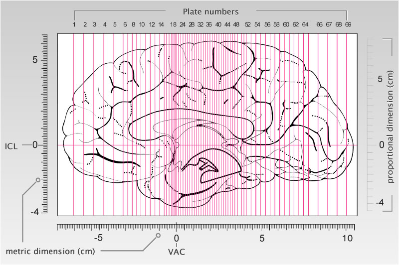 Detailed Atlas of the Human Brain in Stereotaxic Coordinates.