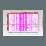 Placement of all 69 (20 &micro;m) sections indicated. Metric stereotaxic grid system for all three dimensions.