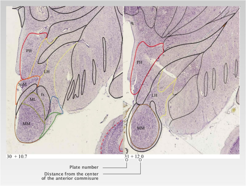  Detailed Atlas of the Human Brain in Stereotaxic Coordinates.