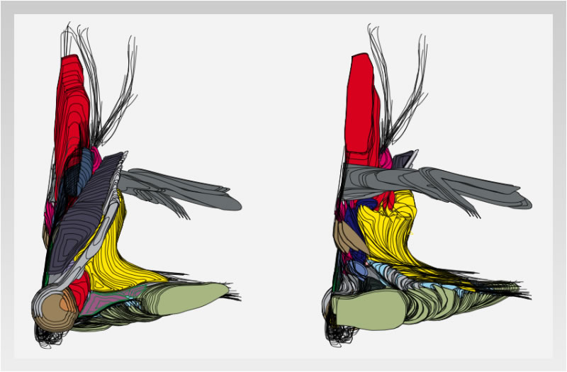  Detailed Atlas of the Human Brain in Stereotaxic Coordinates.