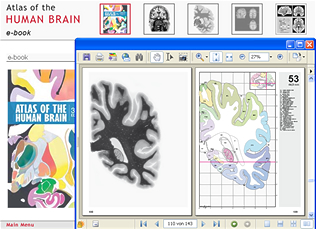E-book with atlas plate selected. The user has the possibility to display photographs and line drawings at high magnification and to make use of printouts as templates for own studies.