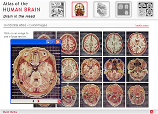 The Horizontal Atlas: Full color anatomical sections.