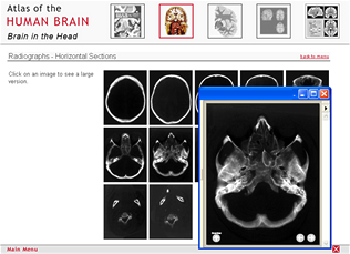 Radiographs of the horizontal atlas.