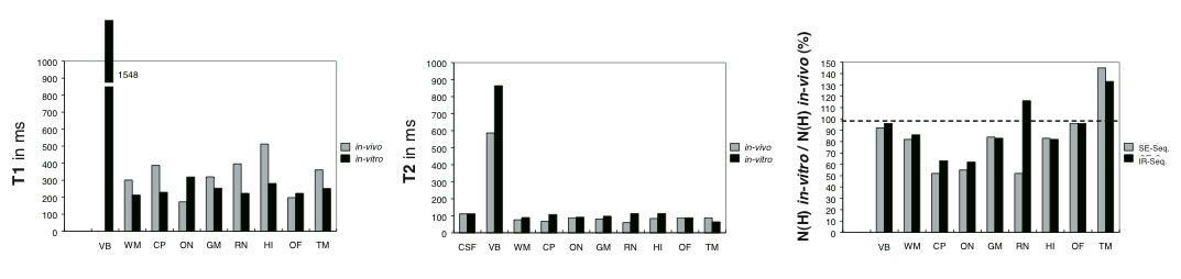 Comparison between in vivoand in vitrotissues (A,B)
T1 (spin-lattice relaxation, A) and T2 (spin-spin relaxation, B)
values (in ms) determined for the following regions of interest:
VB: vitreous body; OF: orbital fat; ON: optic nerve; HI: hippo-
campus; WM: white matter; GM: gray matter, CP: cerebral
peduncle; RN: red nucleus; TM: temporalis muscle, CSF: cere-
brospinal fluid. Comparison between in vivoand in vitrotissues (A,B)
T1 (spin-lattice relaxation, A) and T2 (spin-spin relaxation, B)
values (in ms) determined for the following regions of interest:
VB: vitreous body; OF: orbital fat; ON: optic nerve; HI: hippo-
campus; WM: white matter; GM: gray matter, CP: cerebral
peduncle; RN: red nucleus; TM: temporalis muscle, CSF: cere-
brospinal fluid.
