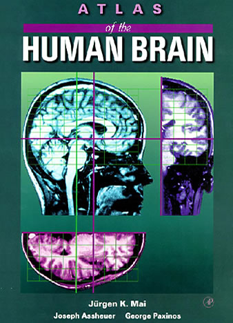 Atlas of the Human Brain &ndash; First edition 1995 (Paperback)