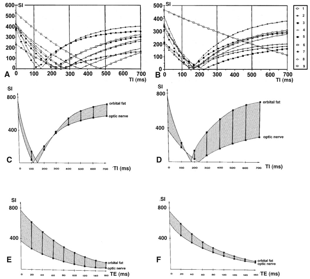 (A, B) Comparison between in vivo (A) and in vitro(B) 
	signal intensity (SI) measurements using IR sequences with different T1 (50 - 700 ms) at constant TR (5000 ms) for the follo- 
	wing tissues: 1: vitreous body, 2: orbital fat, 3: optic nerve, 4: 
	hippocampus, 5: white matter, 6: gray substance, 7: cerebral 
	peduncle, 8: red nucleus, 9: temporalis muscle.