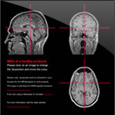 The MRI-Navigator provides the visualization of a MR-image data set from a 30 year old male volunteer.