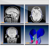 In the MR-Muscles section you will have the possibility to interactively navigate through the muscles in the Human head.