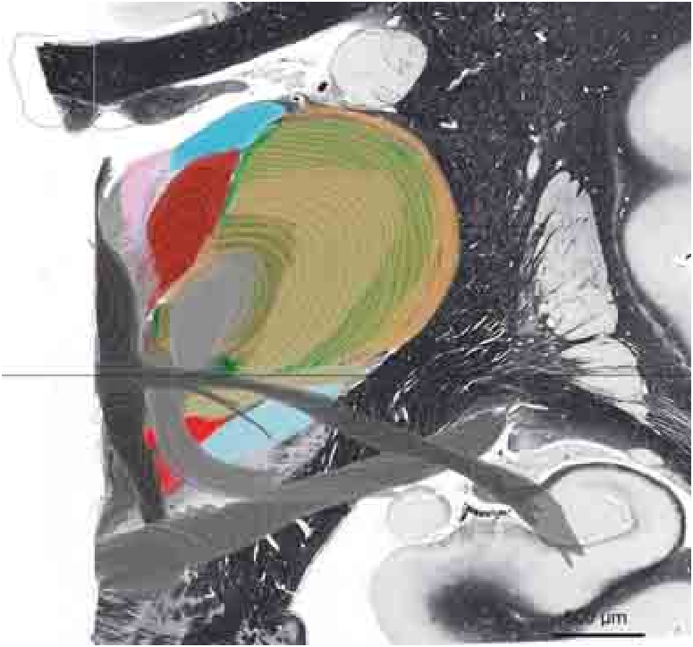 3D Views of the Human Brain