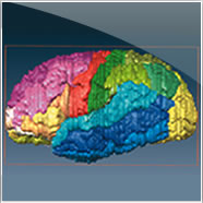 3D Volume Reconstructions