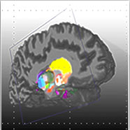 Interactive 3D and Navigation in the Human Brain