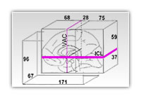 (ICL: intercommissural line, VAC: vertical through the center of the anterior commissure)