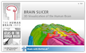 Screenshot from the Inderactive Application: This platform allows you to interactively navigate within the 3D atlas brain in real time,
to visualize segmented cortical and subcortical structures and to slice the brain in every direction.